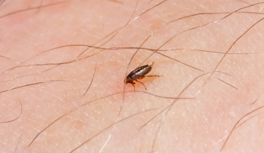 a little flea bites on a human