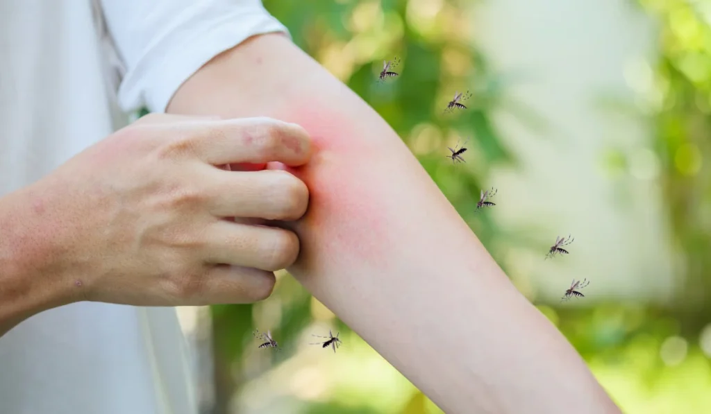 attracted mosquito on human skin